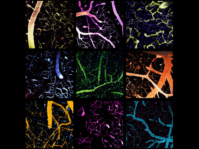 Tortuous Trafficking: Nanoparticles Traverse the Blood Brain Barrier. Images acquired by Joelle Straehla and Jeffrey Wyckoff were showcased as part of the KI Image awards in 2021.